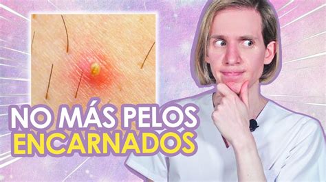 pelo encarnado en el pubis|Cómo quitar los pelos encarnados del pubis